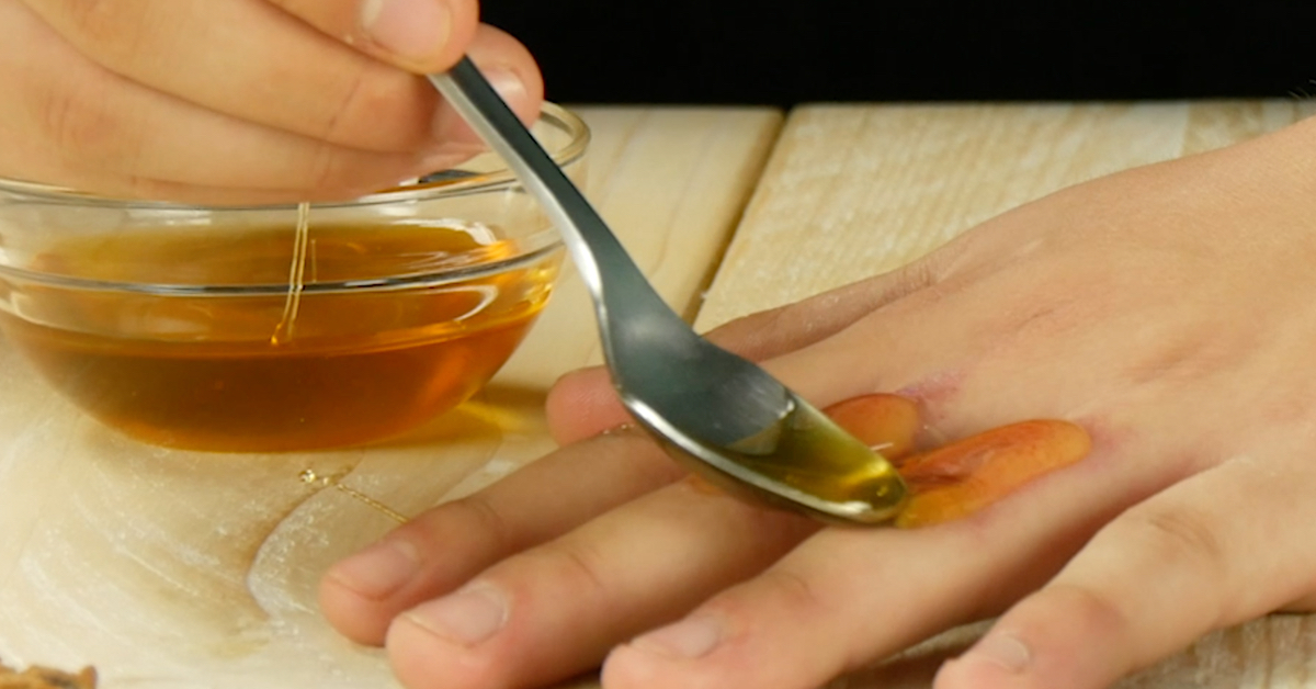 Eine Frau streicht sich mit einem Löffel Honig auf die Hand.
