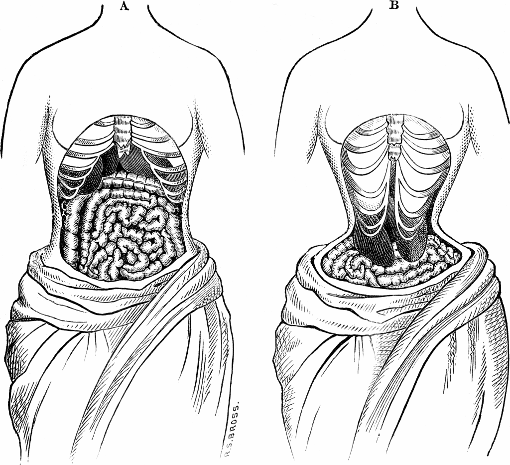 Weiblicher Körper und Organe ohne Korsett vs. eingeschnürter Körper