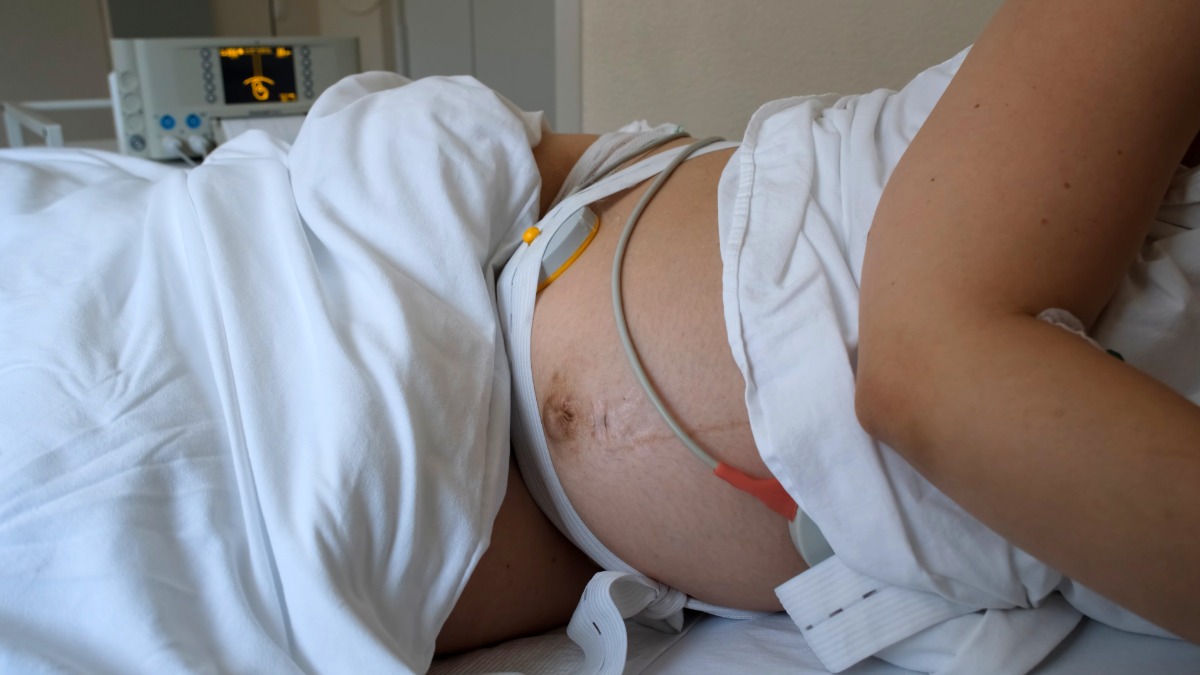 Frau mit Wehenschreiber liegt in einem Krankenhausbett