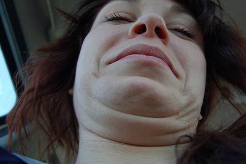 double chin alicia