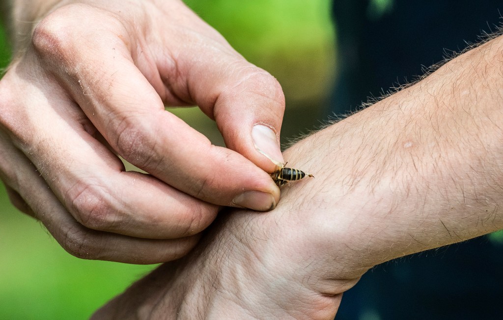 10 Insektenstiche, die du erkennen solltest.