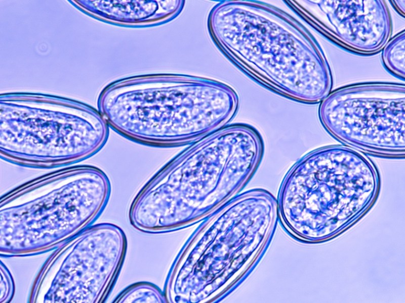 Mikroskopische Aufnahme der Eier eines Madenwurms. Diese Parasiten befallen vor allem Kinder.