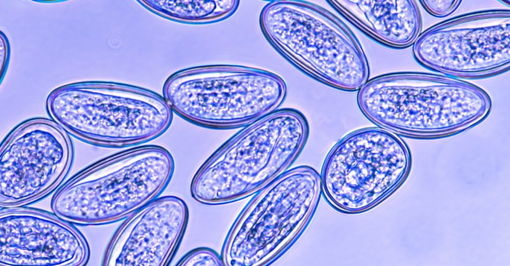 Mikroskopische Aufnahme der Eier eines Madenwurms. Diese Parasiten befallen vor allem Kinder.